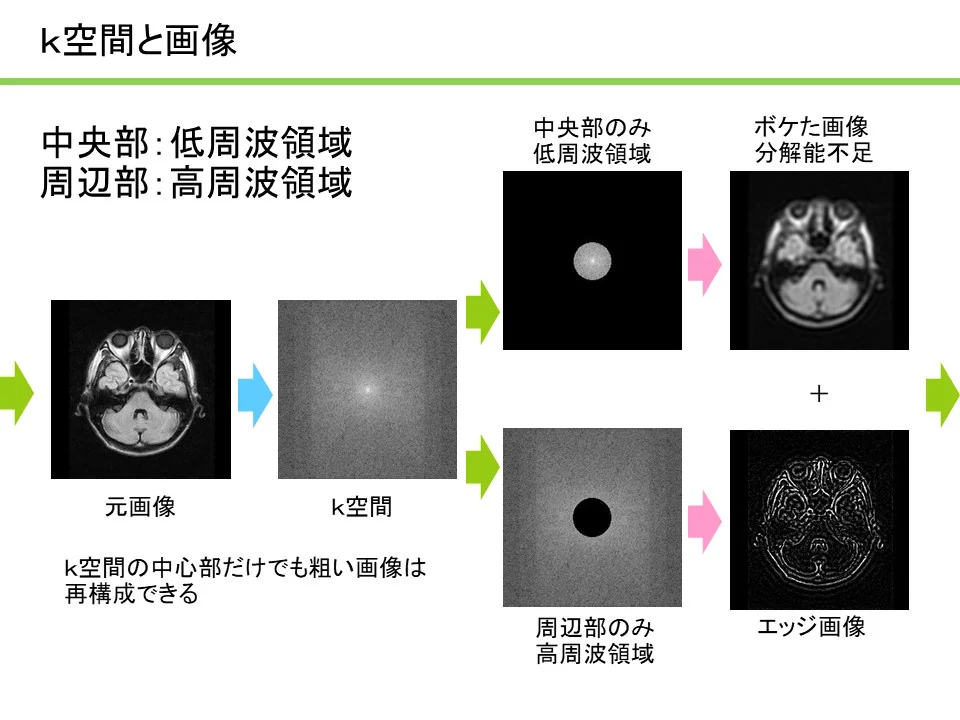 MRIコラム：わかりやすいMRI解説シリーズ その5 ～k空間の理解1