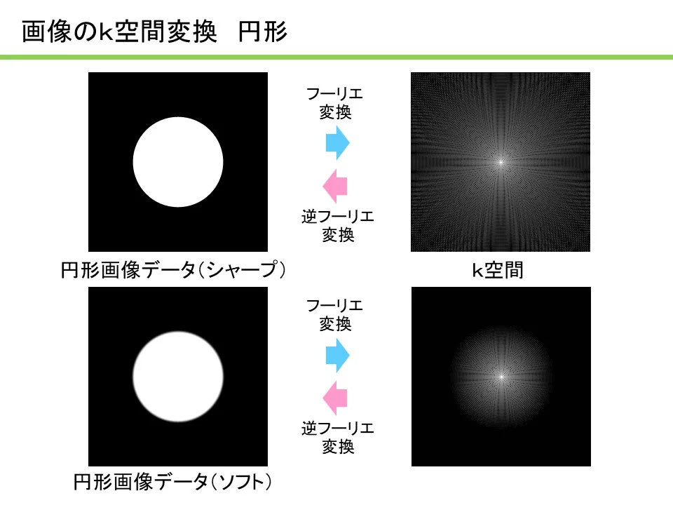 MRIコラム：わかりやすいMRI解説シリーズ その5 ～k空間の理解1