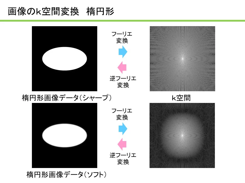 MRIコラム：わかりやすいMRI解説シリーズ その5 ～k空間の理解1