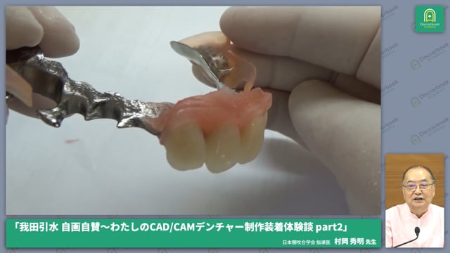 前歯部のリライニング