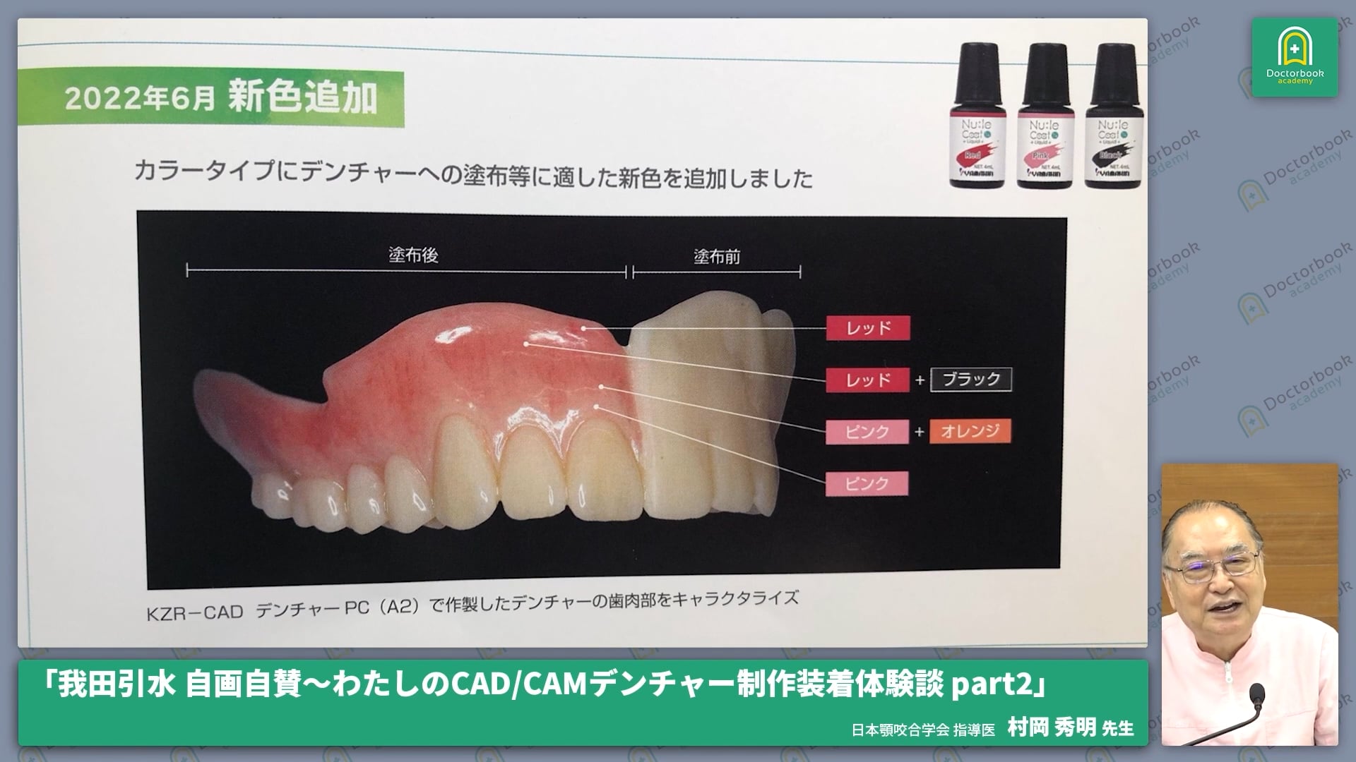 CAD/CAMデンチャー法と無歯顎の義歯作製