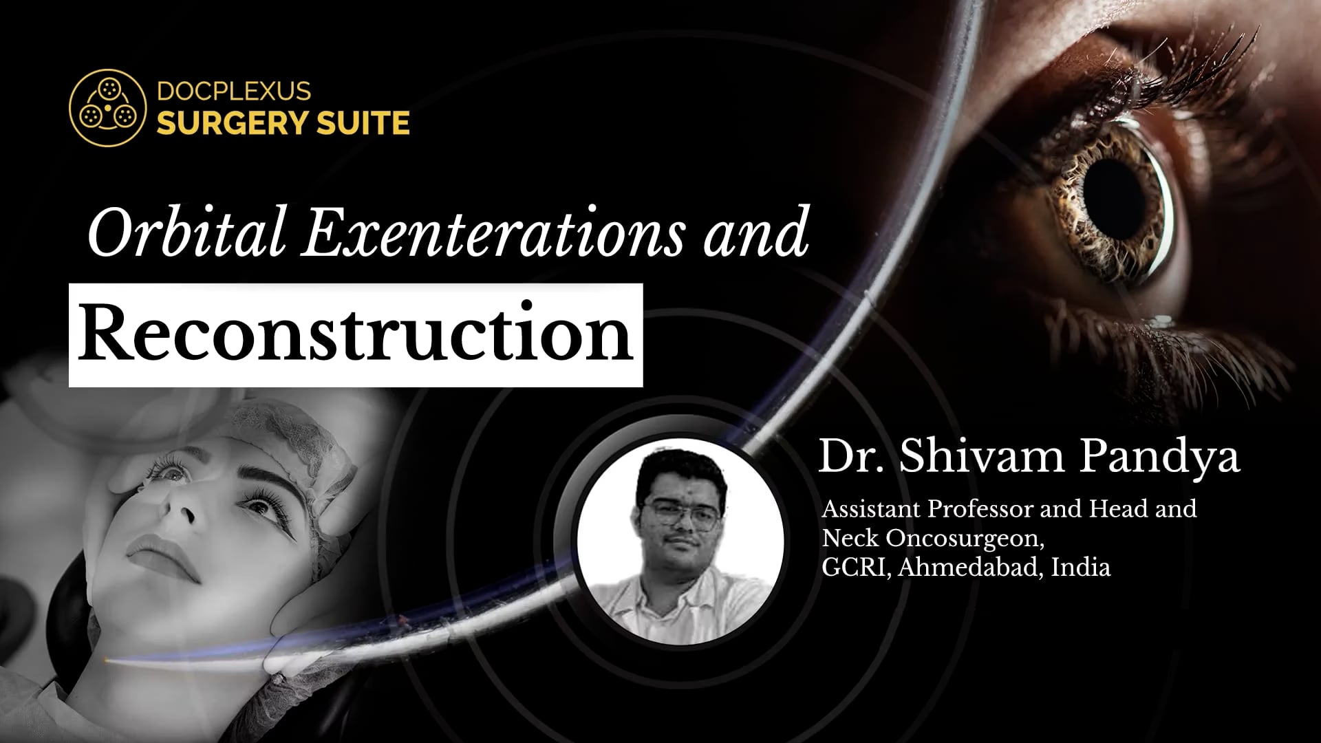 Orbital Exenterations and Reconstruction