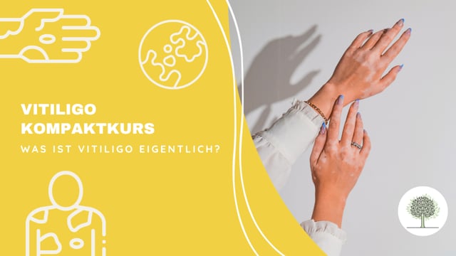 Was ist Vitiligo eigentlich?