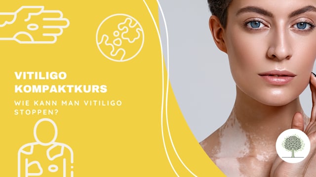 Wie kann man Vitiligo stoppen?