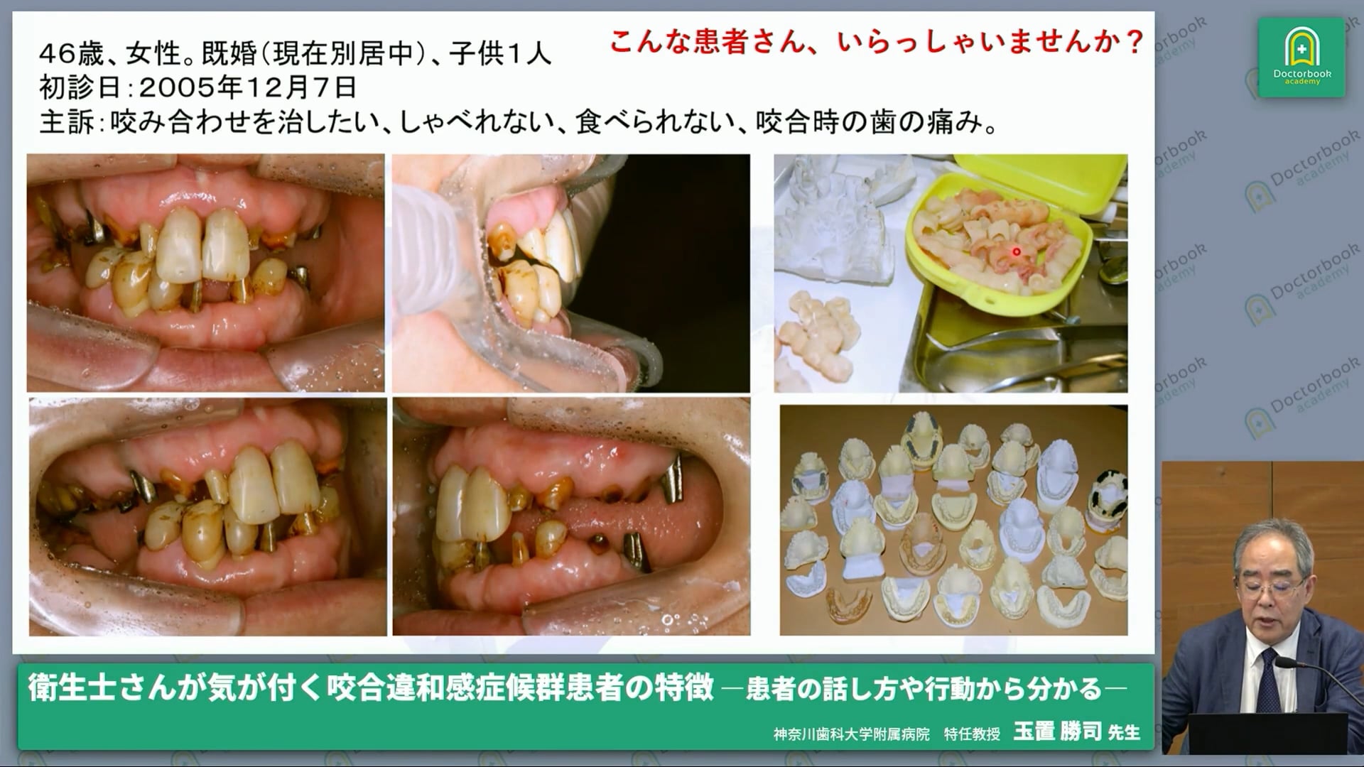 症例による咬合違和感症候群の紹介