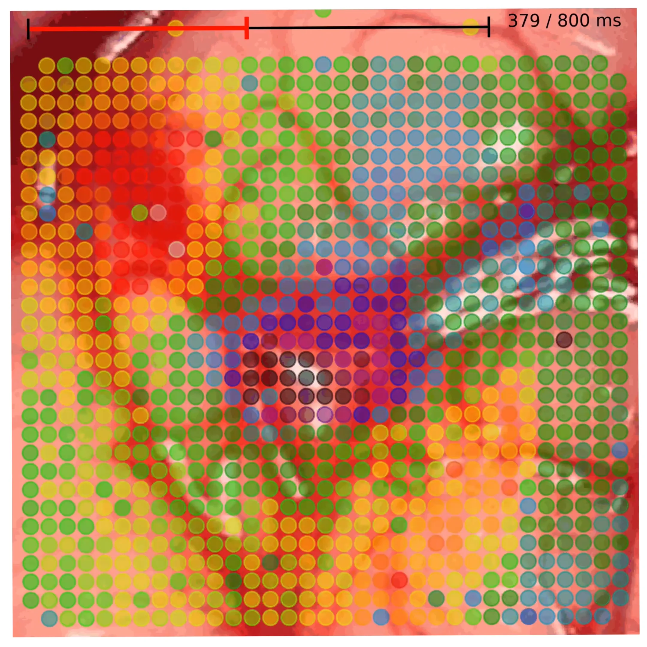 High-resolution Neural Recording - Precision Neuroscience on Vimeo