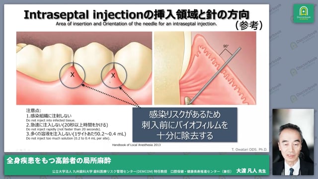 5.できるだけ痛みを与えない局所麻酔 | Doctorbook academy