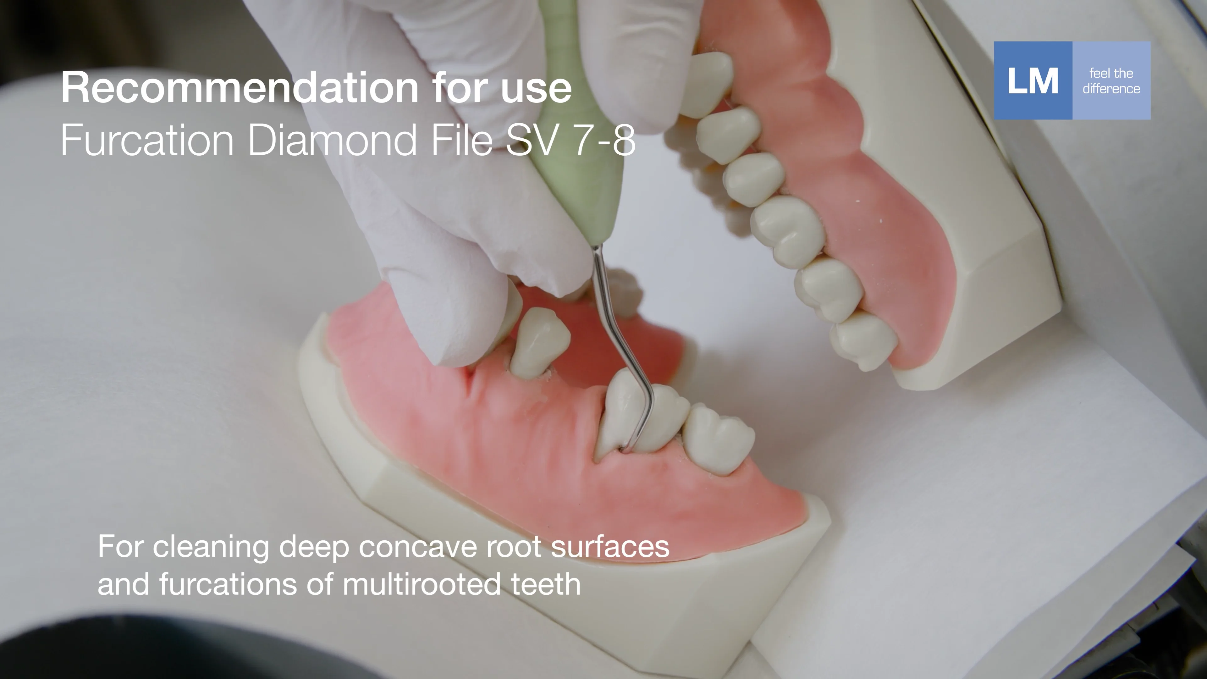 How to use Furcation Diamond File SV 7-8 dental hand instrument on Vimeo