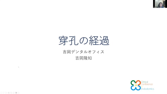 穿孔の経過｜吉岡隆知先生(Topics)