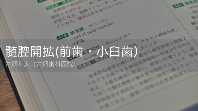 髄腔開拡:アクセスキャビティ(前歯・小臼歯)｜古畑和人先生(Essentials)