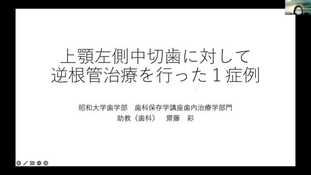 上顎左側中切歯に対して逆根管治療を行った症例｜斎藤彩先生(Topics)