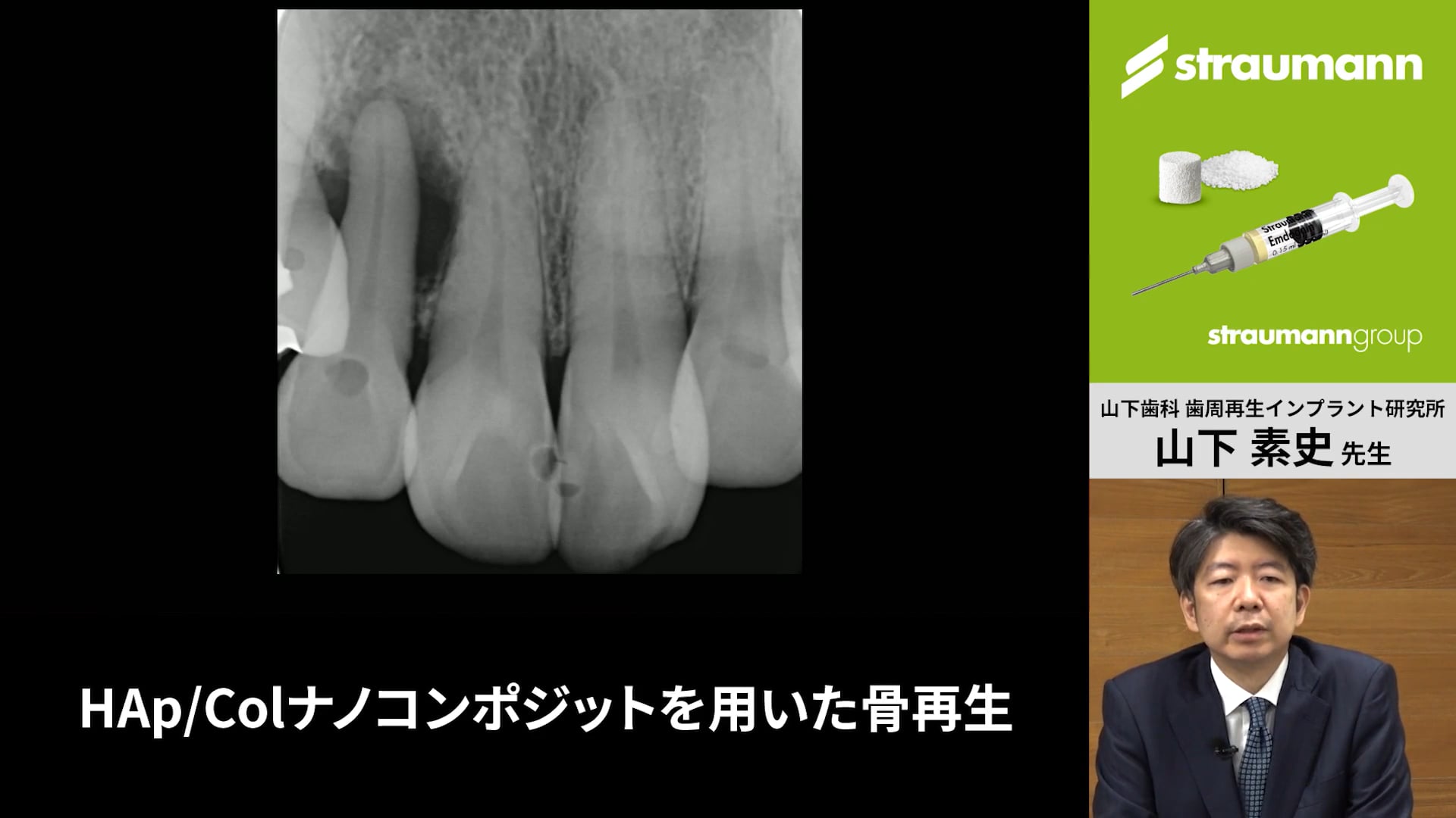 臨床知見録_エムドゲイン_エムドゲインとHAp/Colナノコンポジットを組み合わせるケース