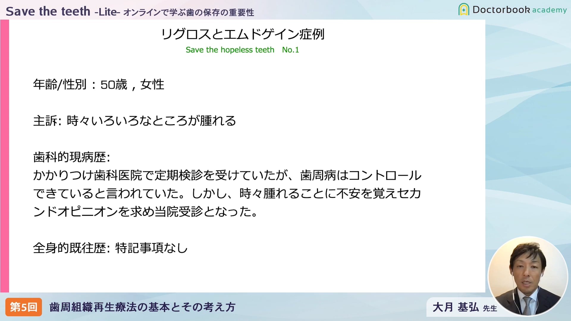 臨床知見録_エムドゲイン_リグロスとエムドゲイン症例