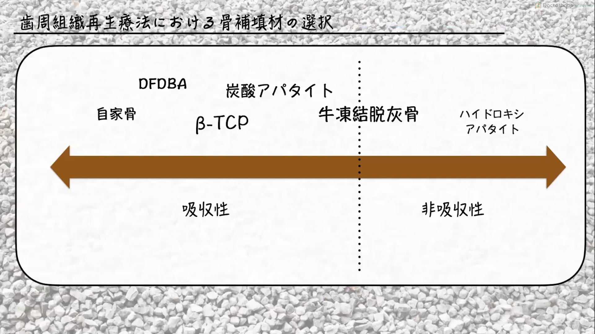 臨床知見録_エムドゲイン_骨補填材の一覧表とその能力