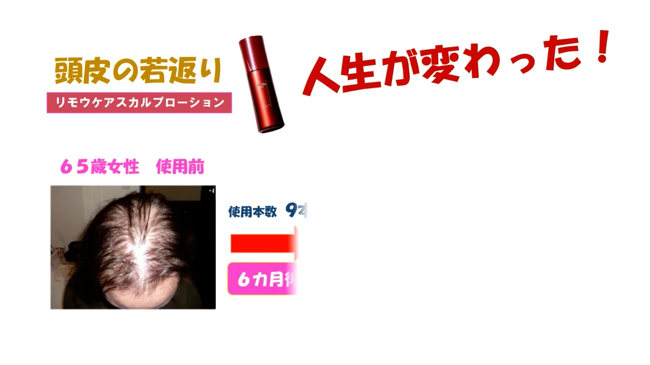 Re;Mou Care（リ;モウケア） | 水の杜