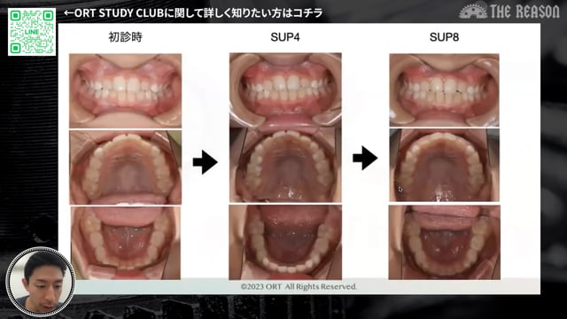 第11回 セカンドオピニオンでこられた9歳男児の症例