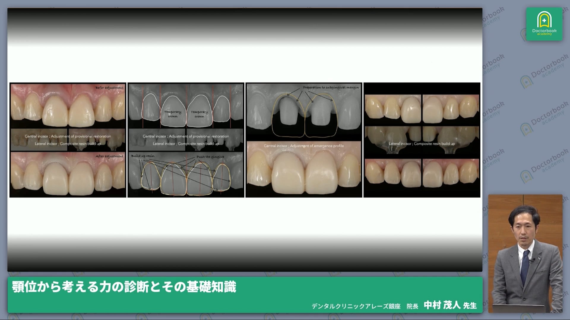 顎運動を正しく理解しよう～基本の「き」～