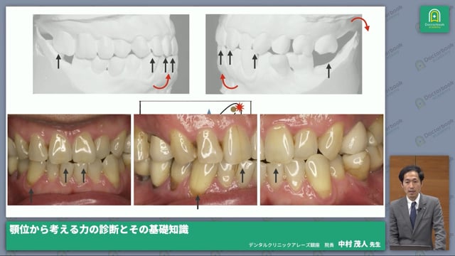 顎位が生体に与える影響～歯や歯周組織、顎関節はどう変化する～