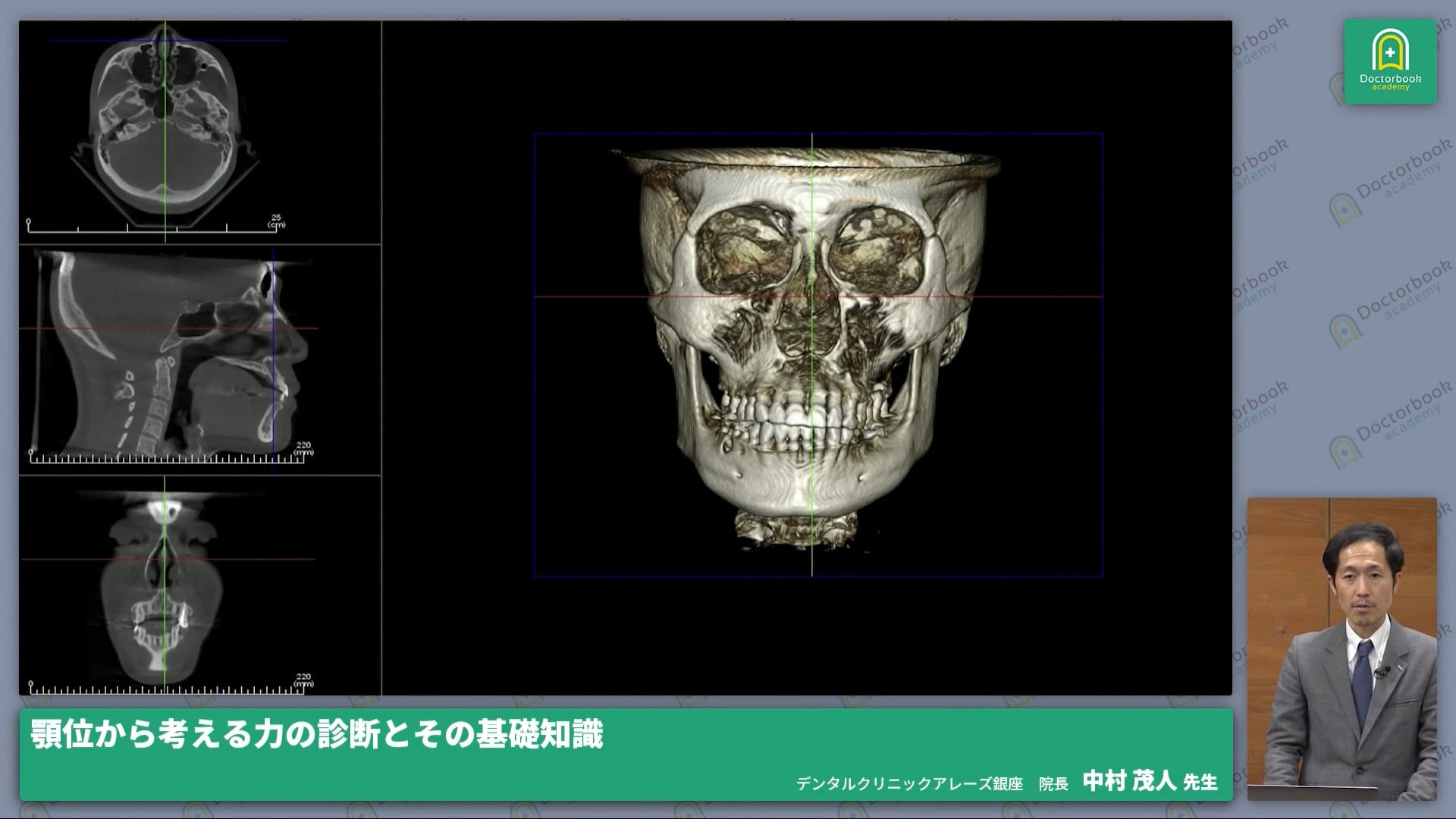 顎位の変位を診断に取り入れる～治療計画立案のコツ～ 