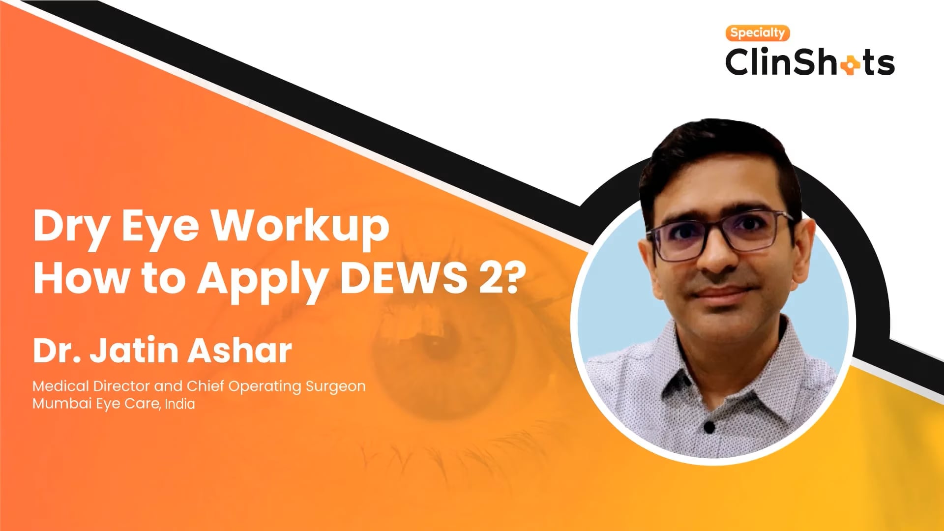 Dry Eye Workup – How to Apply DEWS 2?