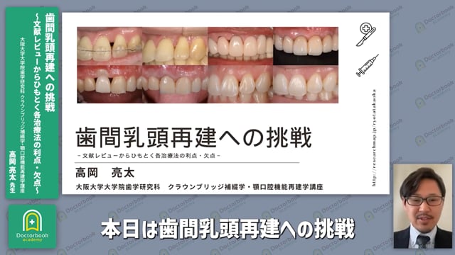 内容紹介丨歯間乳頭再建への挑戦　〜文献レビューからひもとく各治療法の利点・欠点〜