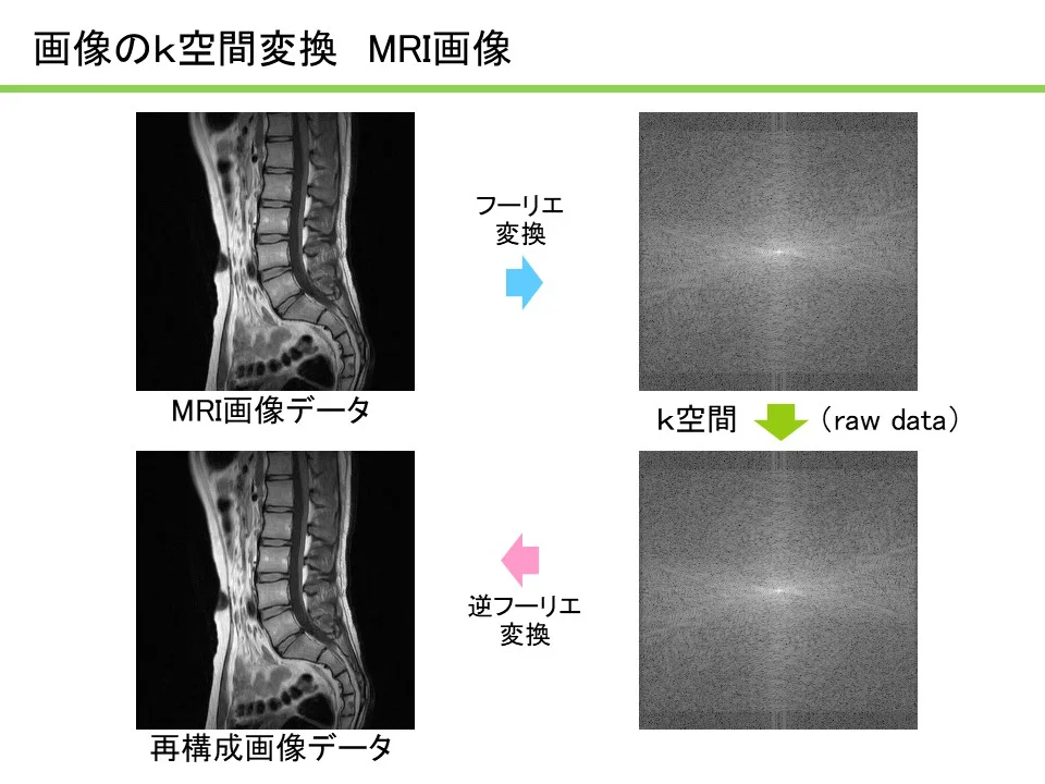 MRIコラム：わかりやすいMRI解説シリーズ その5 ～k空間の理解1