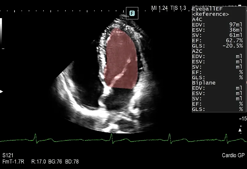 ARIETTA S750：心臓/血管 | 富士フイルム [日本]