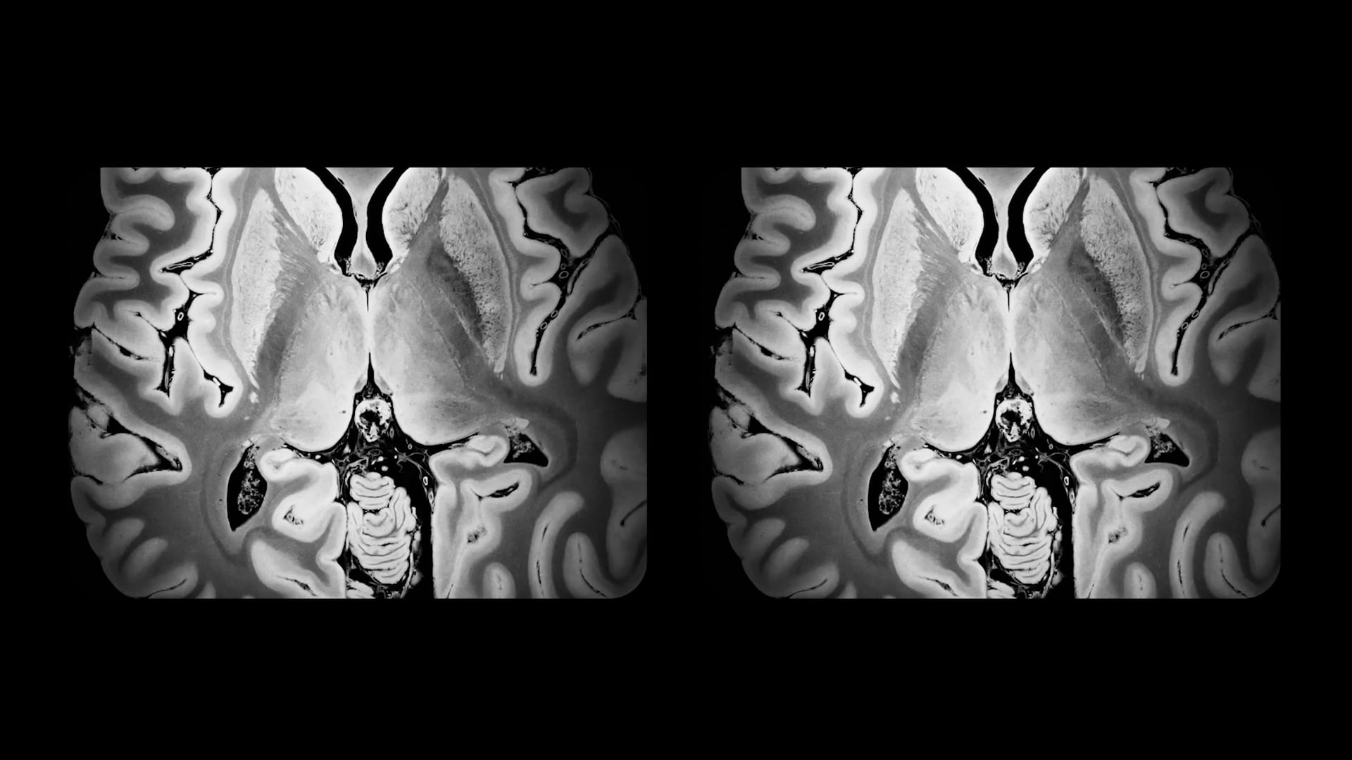 for here am i sitting in a tin can far above the world - TRAILER VOSTFR