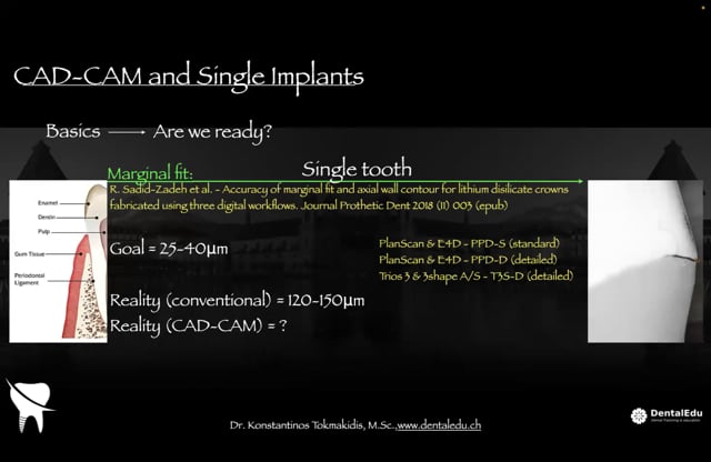 CAD-CAM & Single Implant.
