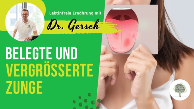 Ist eine belegte und vergrößerte Zunge (Eindrücke der Zähne seitlich) ein Zeichen einer Entzündung im Darm?