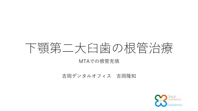 下顎第二大臼歯 MTAでの根管充填｜吉岡隆知先生(Archives)