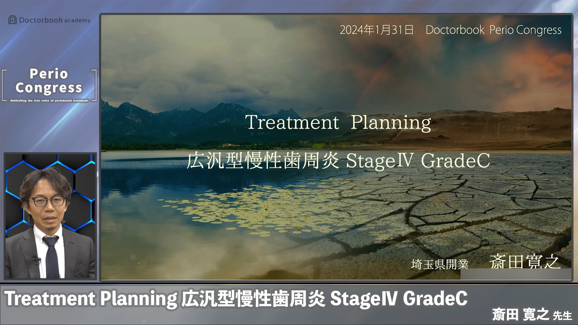 Treatment Planning 広範性型慢性歯周炎（StageⅣ/GradeC）｜斎田寛之先生 義歯Case - ペリオコングレス session5