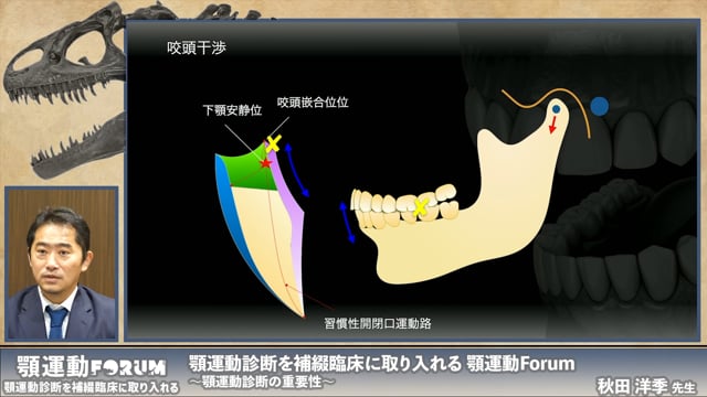 デジタルによる顎運動診断