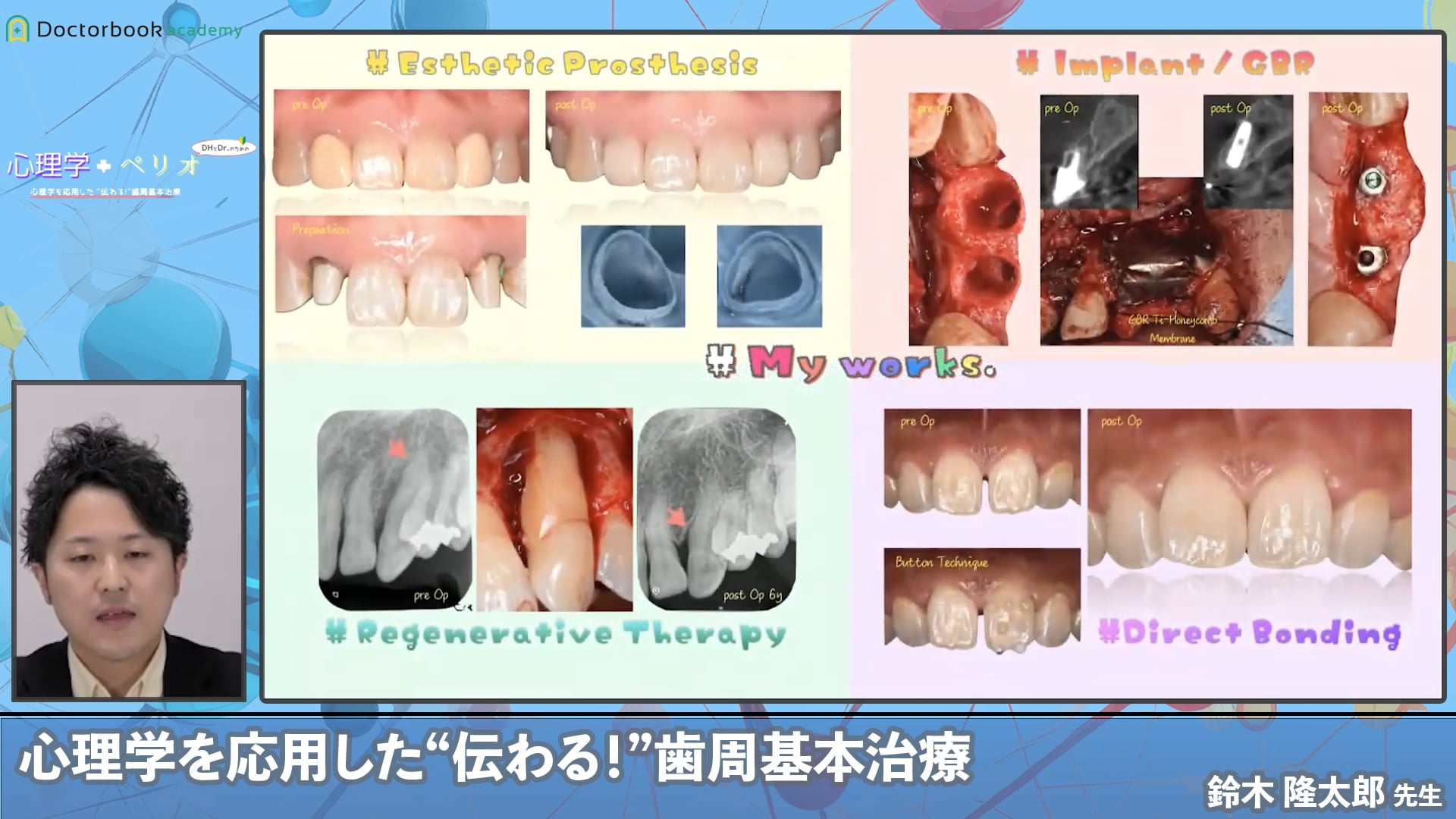 心理学を応用した伝わる歯周基本治療　～導入～