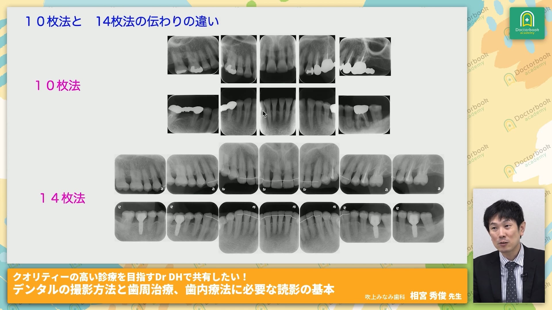 臨床知見録_診査・診断_デンタル10枚法と14枚法の違い