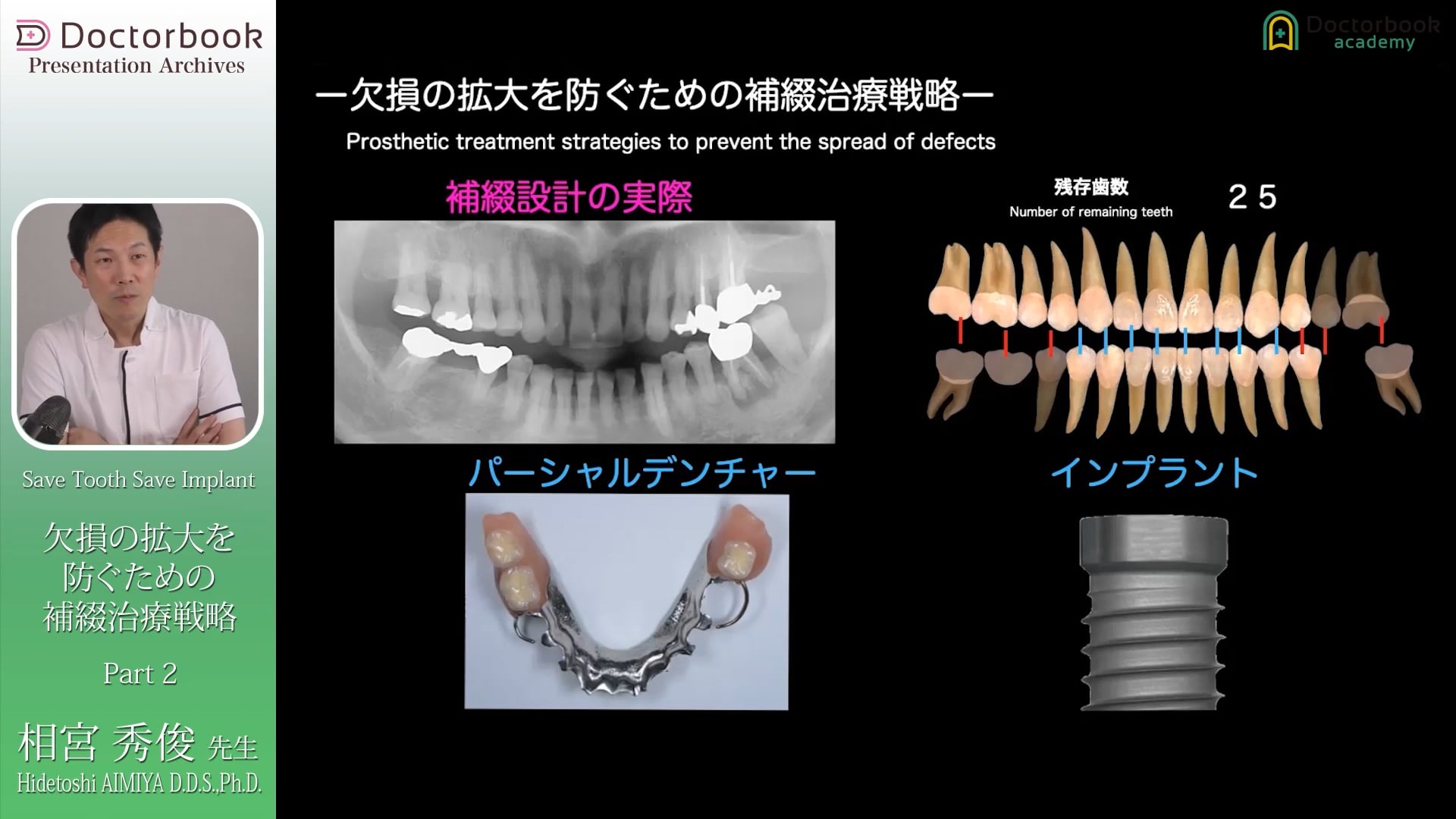 臨床知見録_診査・診断_欠損が生じた時の診査・診断の方法