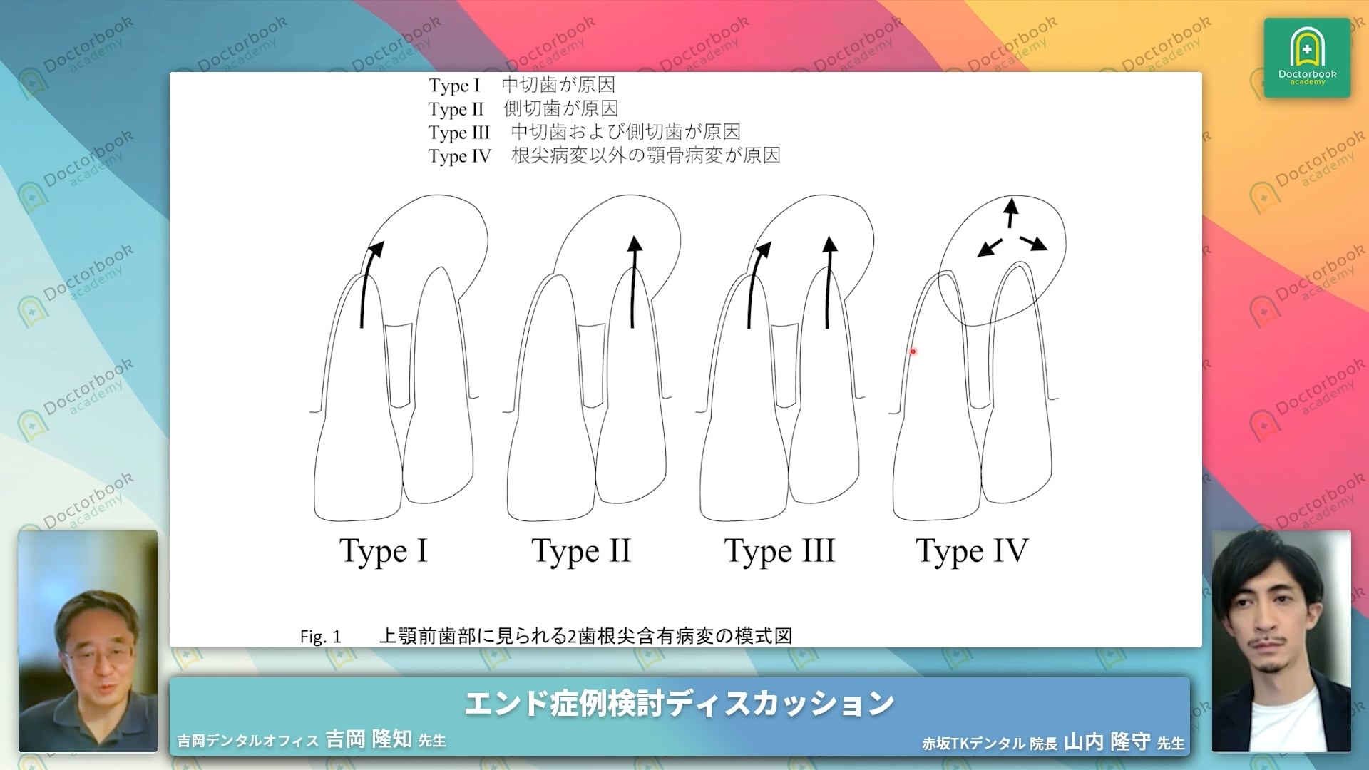 臨床知見録_診査・診断_2歯根尖含有病変のタイプ別診断