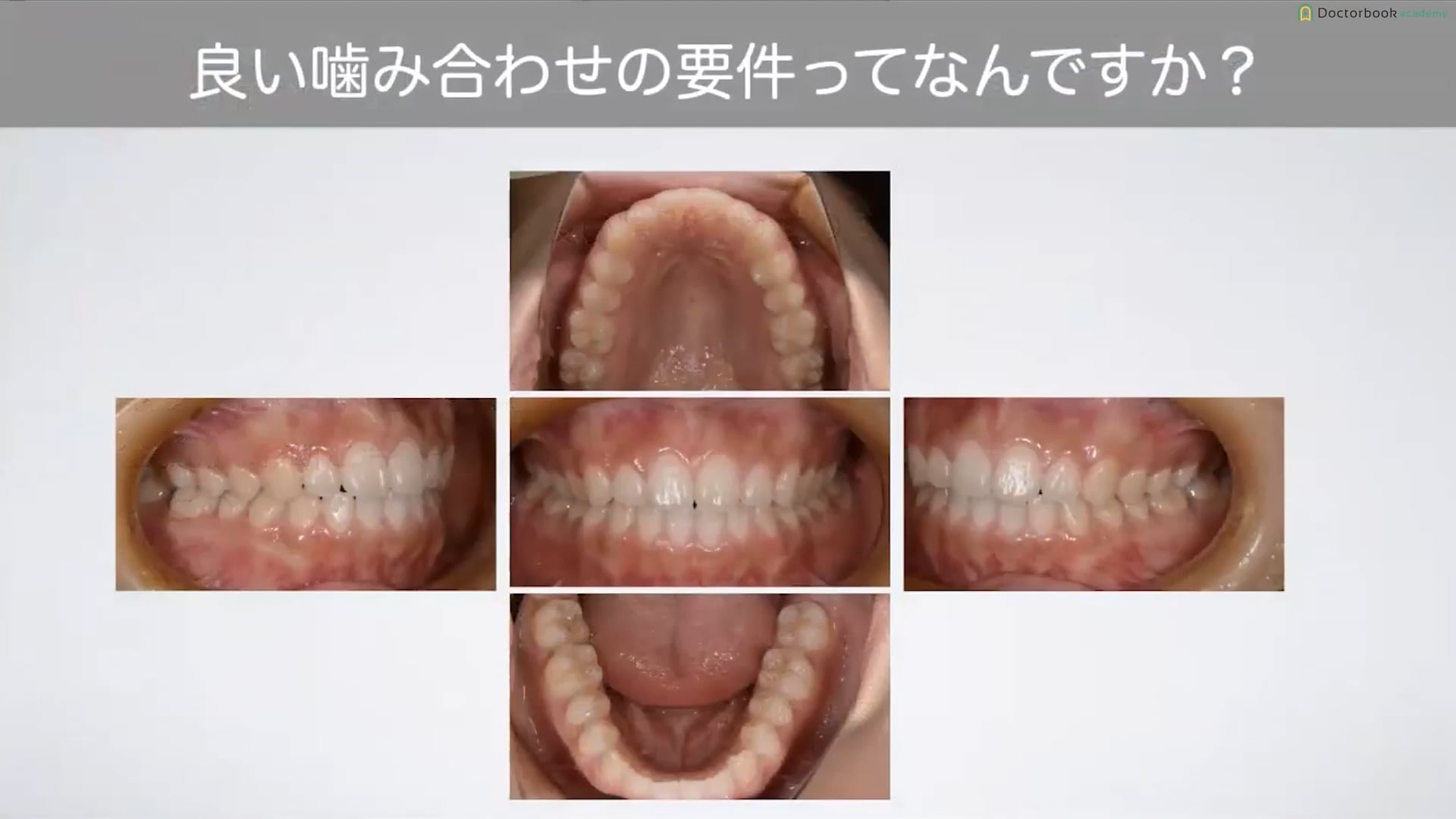 臨床知見録_診査・診断_良い噛み合わせの要件について