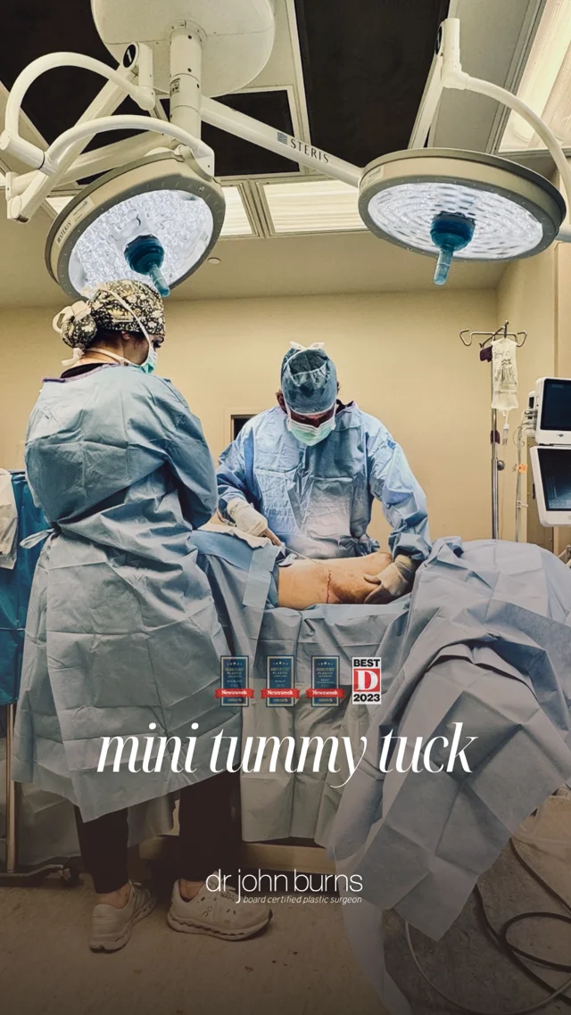 Best Mini Tummy Tuck- Dallas-Top Plastic Surgeon, Dr. John Burns