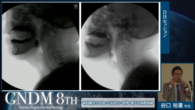 歯科衛生士が知っておきたい摂食・嚥下の基礎知識｜8th Greater Nagoya Dental Meeting DHセッション