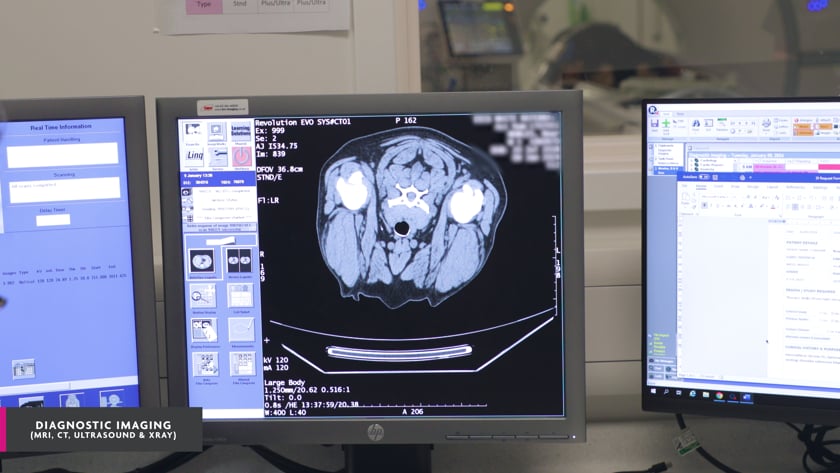 vimeo-video-thumbnail