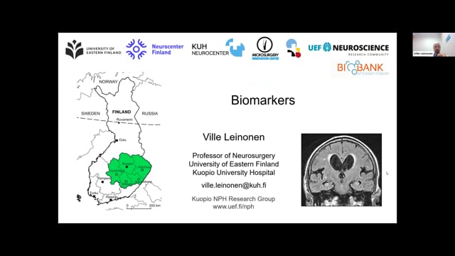 Part 2 Adult Hydrocephalus - Diagnosis
