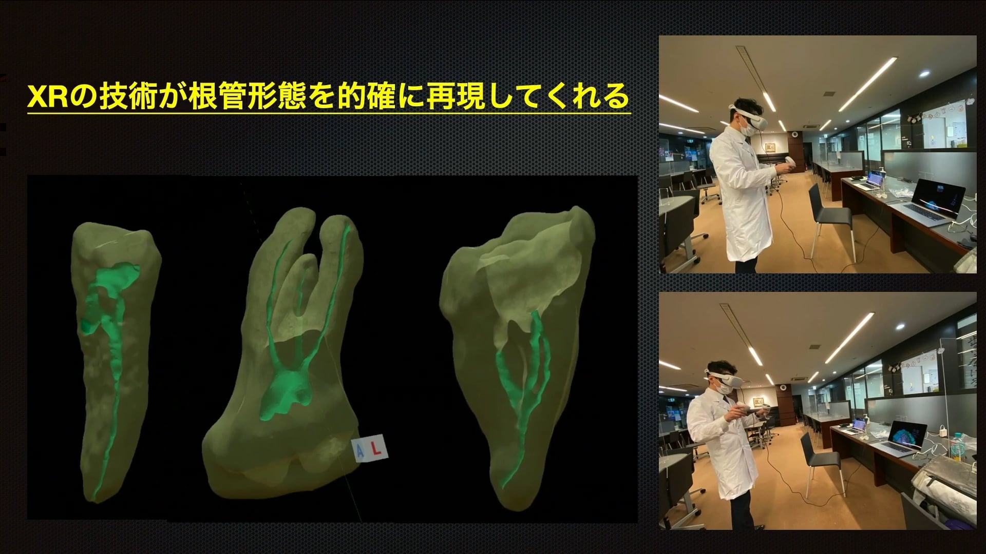 臨床知見録_XR技術_根管解剖のVR技術の応用動画