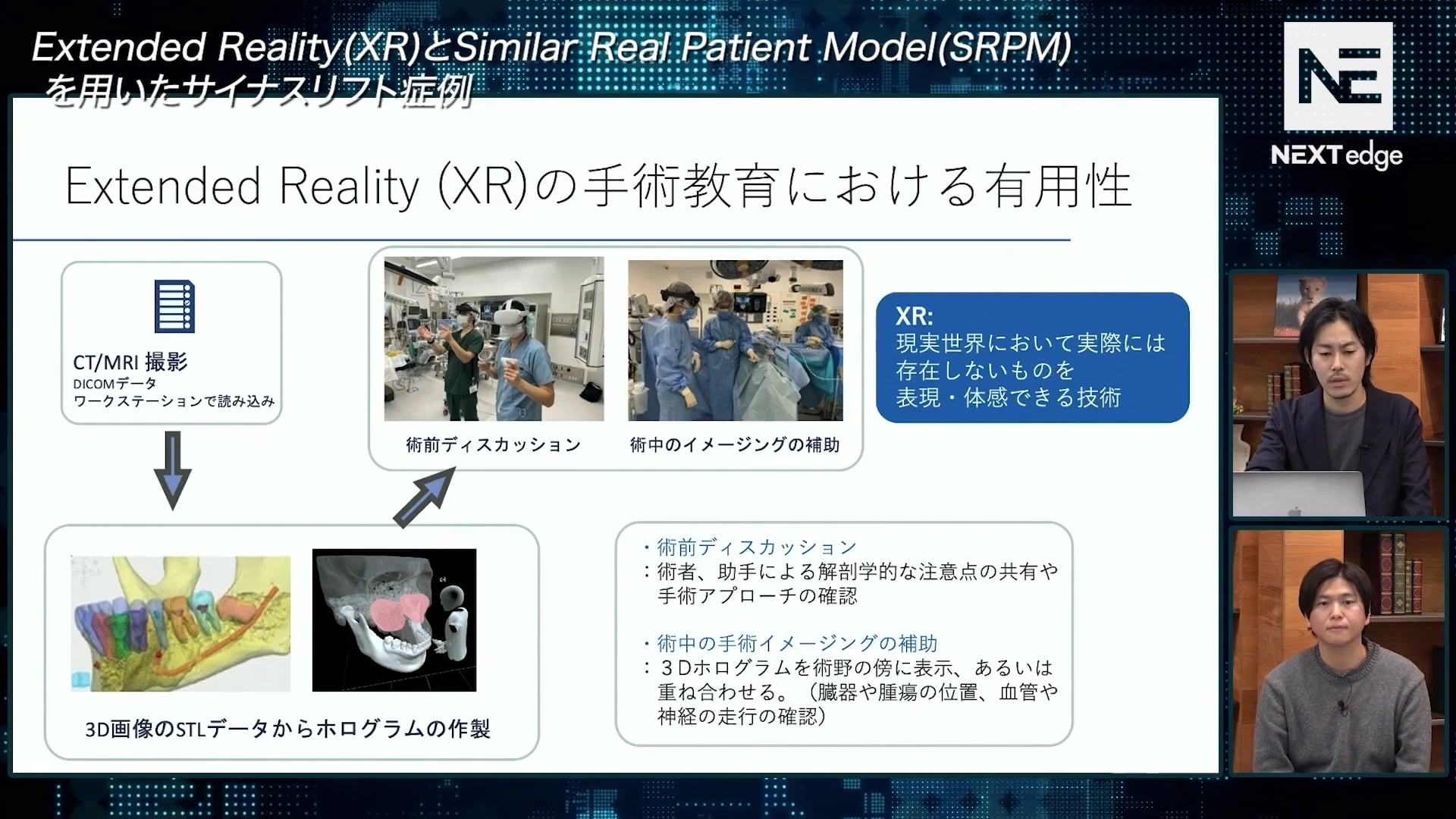 臨床知見録_XR技術_XR技術と3D模型でガイドを作成した症例