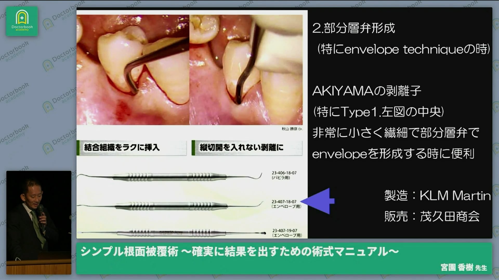 シンプル根面被覆術　～確実に結果を出すための術式マニュアル～│宮園 香樹先生