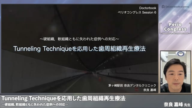 Tunneling techniqueを応用した歯周組織再生療法〜硬組織，軟組織ともに失われた症例への対応〜｜ペリオコングレス session6 マテリアル・テクニック基礎から最新まで