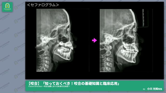 2022新発 咬み合わせ臨床講座 健康・医学 - evernewelectrical.com