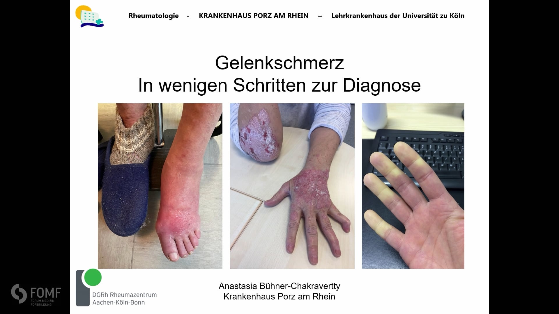 Gelenkschmerz – In wenigen Schritten zur Diagnose