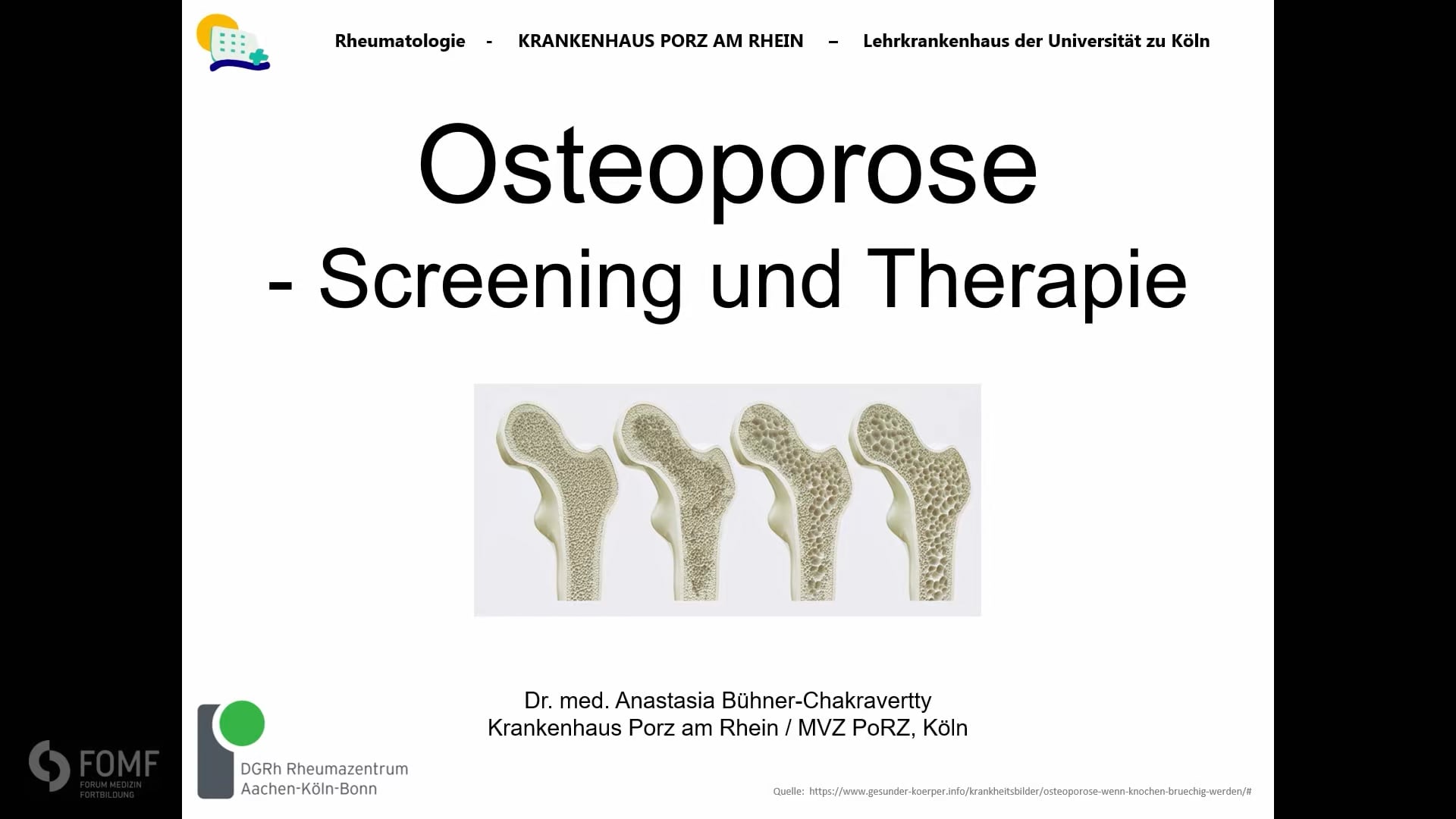 Osteoporose – Screening und Therapie