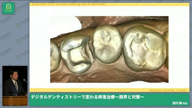 デジタルデンティストリーで変わる修復治療　～限界と対策～│田代 剛先生